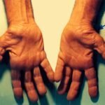 carpal-tunnel-syndrome-physiotherapy-rohtak