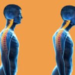 neck-and-head-posture-correction