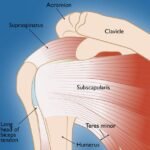 rotator-cuff-injury-physiotherapy-rohtak